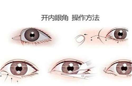 上海美仑整形医院正规吗？主打项目介绍