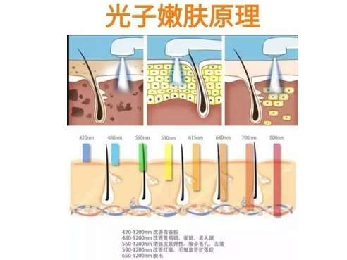  m22光子嫩肤的价格是多少？作用有哪些？