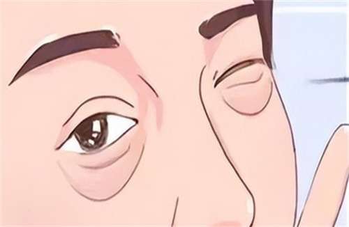 上海仁泉医疗美容祛眼袋多少钱？2025年价格查看