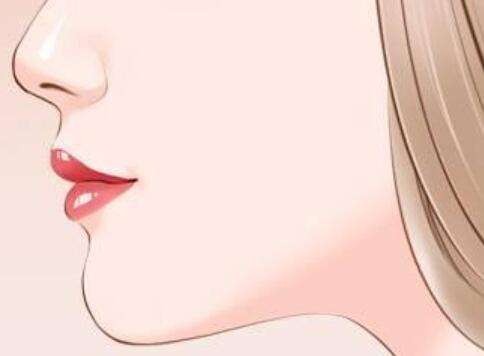 玻尿酸隆鼻1到7天恢复过程图片怎么样?详细过程这里看
