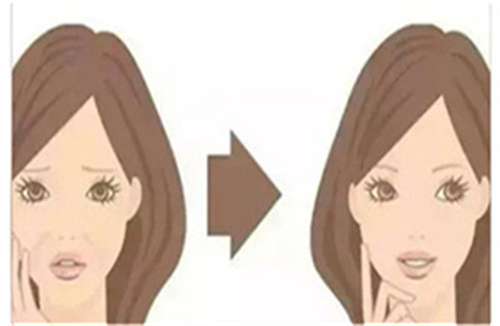 aopt超光子有什么效果?aopt超光子会保持多久?