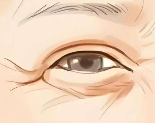 嗨体去眼纹结果怎么样?分享热门项目资料一览