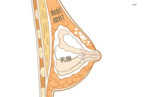 自体脂肪丰胸的副作用和危害？自体脂肪丰胸恢复期？