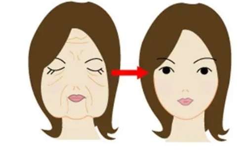 射频除皱拉皮怎么样？有什么副作用？