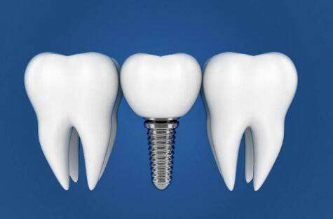 福建省第二人民医院口腔科怎么样？医生简介、顾客点评这里看