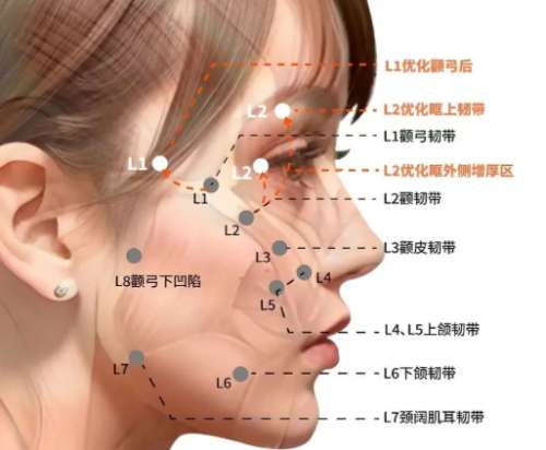韧带提升和筋膜提升的区别是什么？速看区别在哪？
