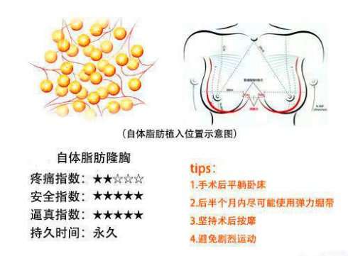 刘成胜脂肪丰胸是脂肪胶吗？脂肪胶是神奇魔法吗?