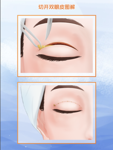 截屏2025-07-05 14.36.39.png