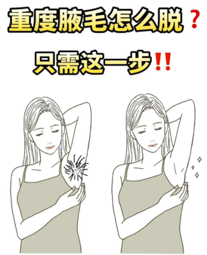 腋毛怎么去除？清爽腋下的 “美丽锦囊”