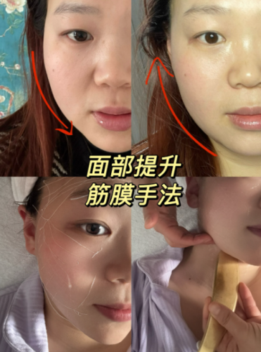 北京筋膜提升在哪个医院好一点呢?解锁新的逆龄密码