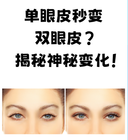 单眼皮做成双眼皮要多少钱？ “变美账单”背后的秘密大公开