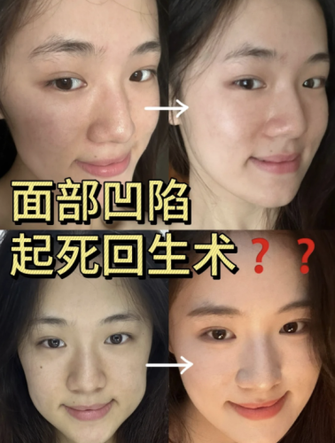 截屏2025-07-08 22.44.56.png