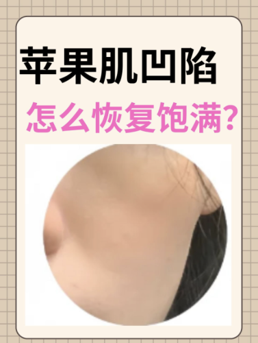 截屏2025-07-08 22.47.13.png