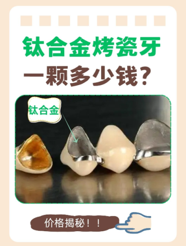 钛合金烤瓷牙多少钱？不同牙齿情况有不同账本