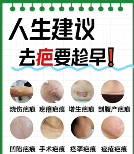 如何去疤痕？从类型到方法的针对性方案