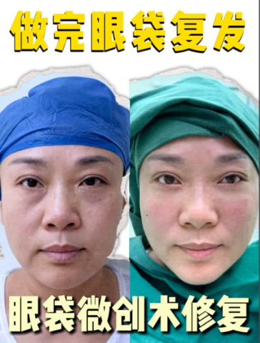 北京哪里做眼袋修复好？不同医院的修复优势一一呈现