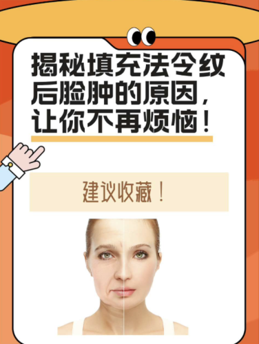 填法令纹会肿吗？别慌，今天深扒肿胀原因和急救攻略！