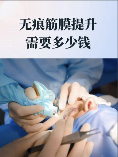 筋膜提升价格一般多少？ 手术方式：价格分层的基础