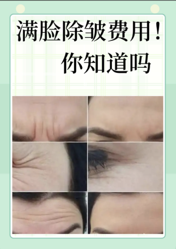 滨州第二人民医院除皱手术怎么样？主打的就是一个安心！