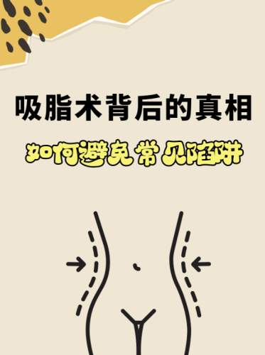 武汉协和医院吸脂多少钱？手术方式选对，花钱不冤枉
