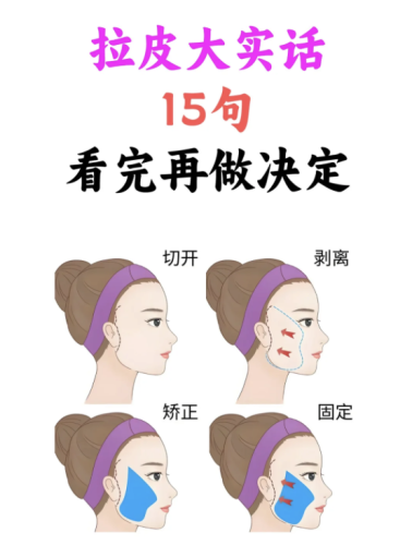 截屏2025-07-22 22.31.32.png