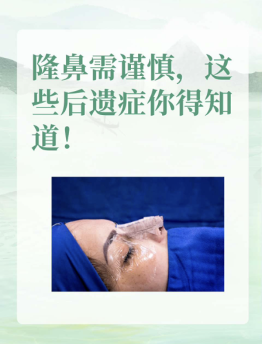 截屏2025-07-22 22.37.08.png