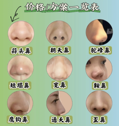 截屏2025-07-24 23.11.08.png