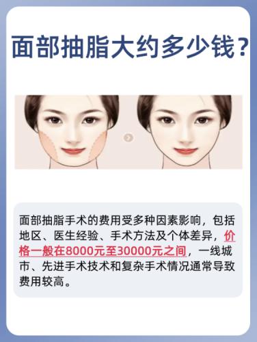 重庆医科大学附属永川医院吸脂多少钱?知名专家收费高
