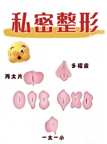 海南省人民医院私密整形怎么样?无创操作+快速恢复,悄咪咪变美就靠它!