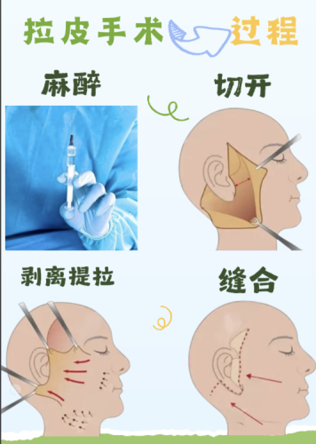 截屏2025-07-28 21.35.58.png