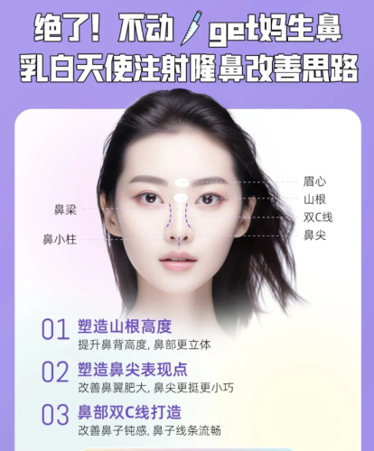 注射隆鼻后多久恢复自然?一周后肿胀消了,就能看出精致鼻型