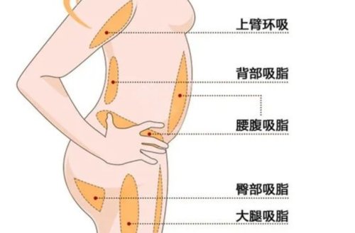 烟台烟台山医院吸脂多少钱?价格、专家与注意事项