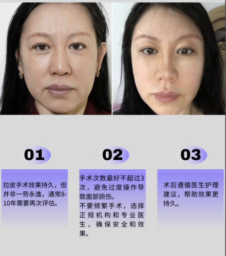 截屏2025-07-31 23.09.14.png