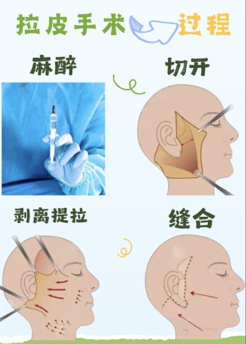 截屏2025-08-02 20.25.18.png