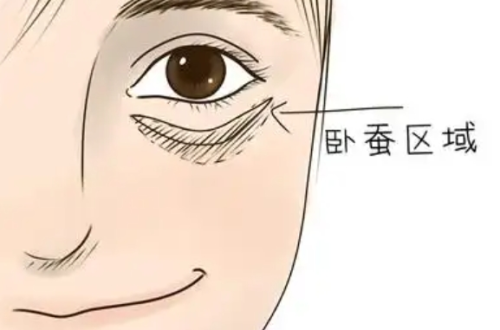 卧蚕填充用什么填好？这些重点一定要知道