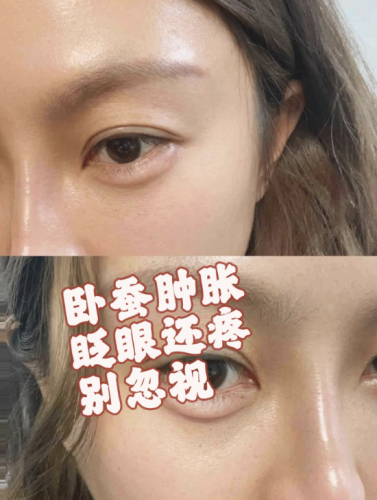 截屏2025-08-03 21.58.15.png