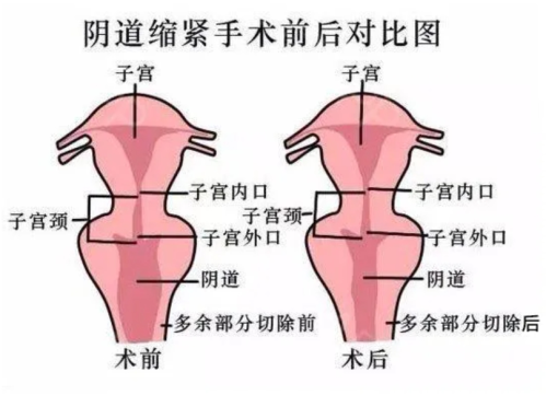 西南医科大学附属医院私密整形怎么样？打破你的误区