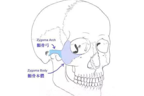 颧骨颧弓整形现在价钱，先别急着问价格，把功课做齐再说