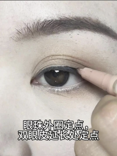 定点双眼皮多久恢复自然？不那么假呢？