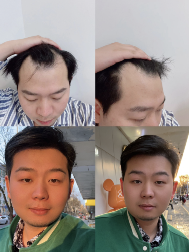 截屏2025-08-10 12.52.01.png