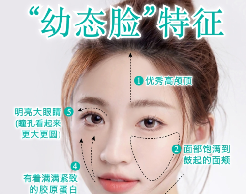 打幼态脸主要是用什么注射的？别让脸先你一步“显老”