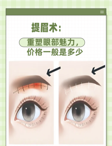 宁波珈禾医美提眉术多少钱？来看张女士，“做了提眉术，感觉自己年轻了10岁，这8000块花得太值了！”