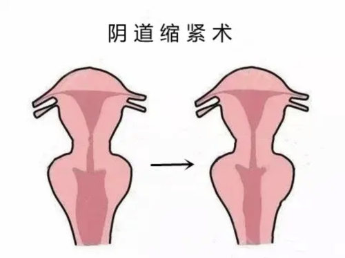 截屏2025-08-14 23.44.54.png
