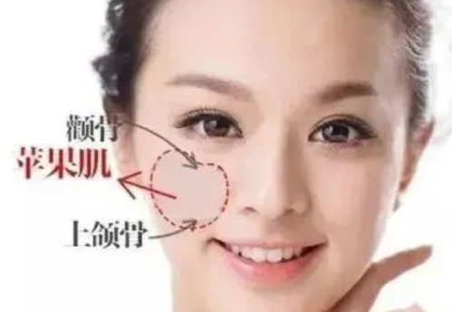 填苹果肌泪沟出来了怎么办？别慌，这里有全套补救指南！