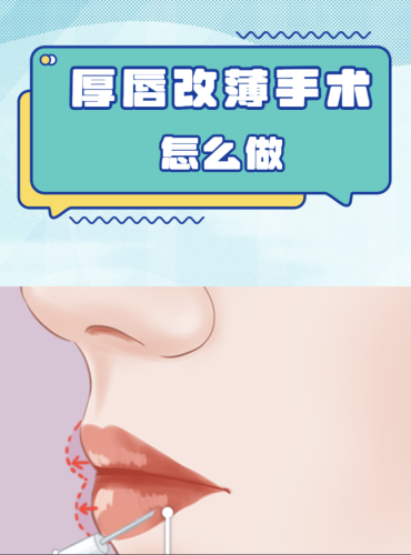 截屏2025-08-15 22.31.32.png