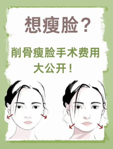黑龙江艺星整形瘦脸多少钱?全脸吸脂 15000 元 + 闺蜜折扣 500 元 + 礼包 600 元,实际省了 1100 元