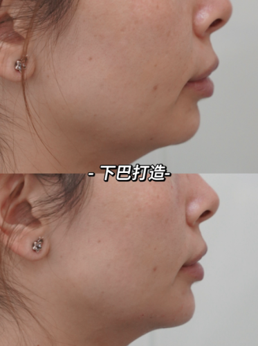 截屏2025-08-15 20.34.07.png