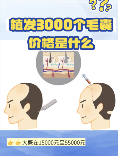截屏2025-08-16 22.14.09.png
