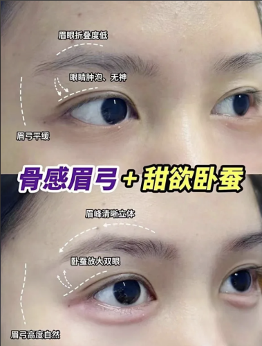 填眉骨用什么填好？选对材料堪比换脸，4 种材料实测 + 避坑指南，看完不纠结