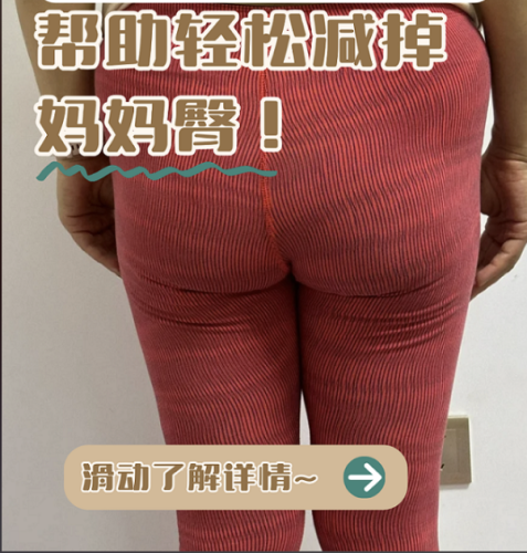 妈妈臀吸脂多久有效果？3个恢复阶段+2张表，吸脂医生揭秘真实时间表